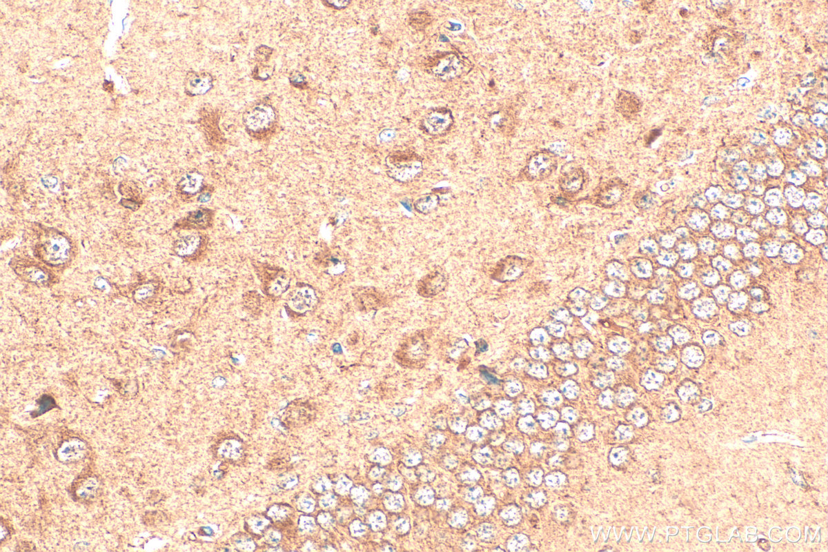 Immunohistochemistry (IHC) staining of mouse brain tissue using SKAP2 Polyclonal antibody (12926-1-AP)