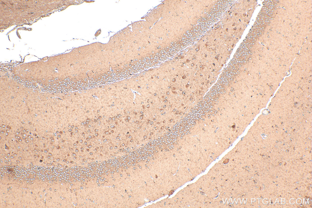 Immunohistochemistry (IHC) staining of mouse brain tissue using SKAP2 Polyclonal antibody (12926-1-AP)