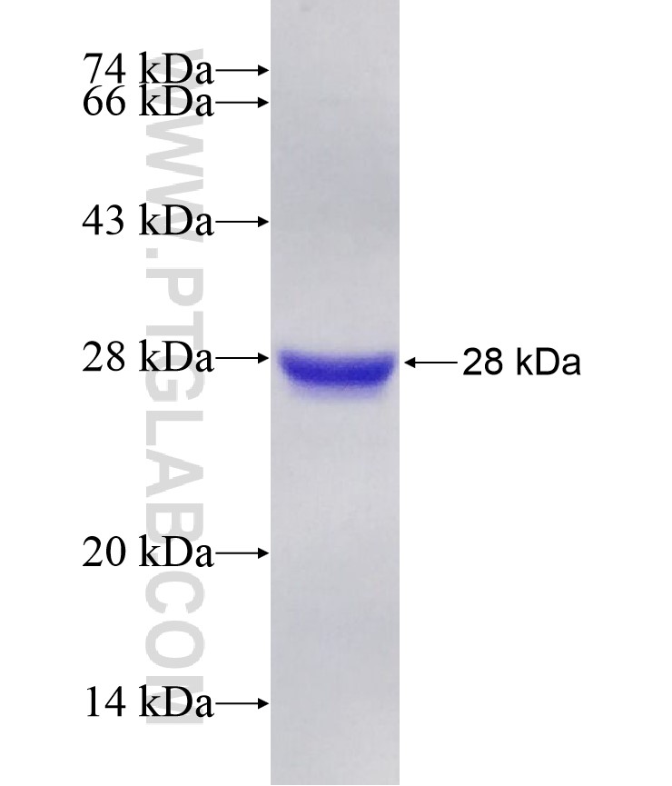 SKI fusion protein Ag28856 SDS-PAGE