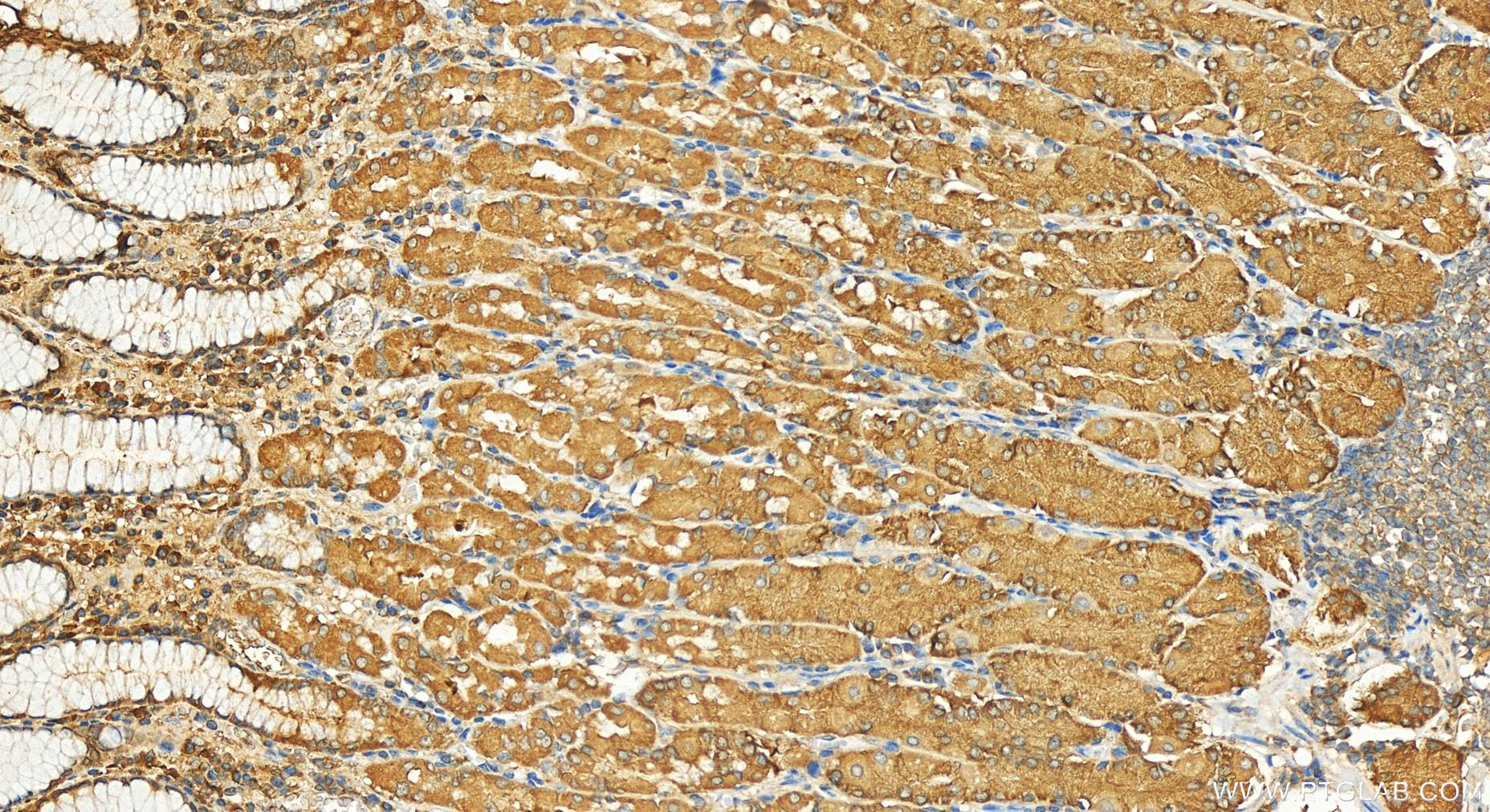 Immunohistochemistry (IHC) staining of human stomach tissue using SKIV2L Polyclonal antibody (11462-1-AP)