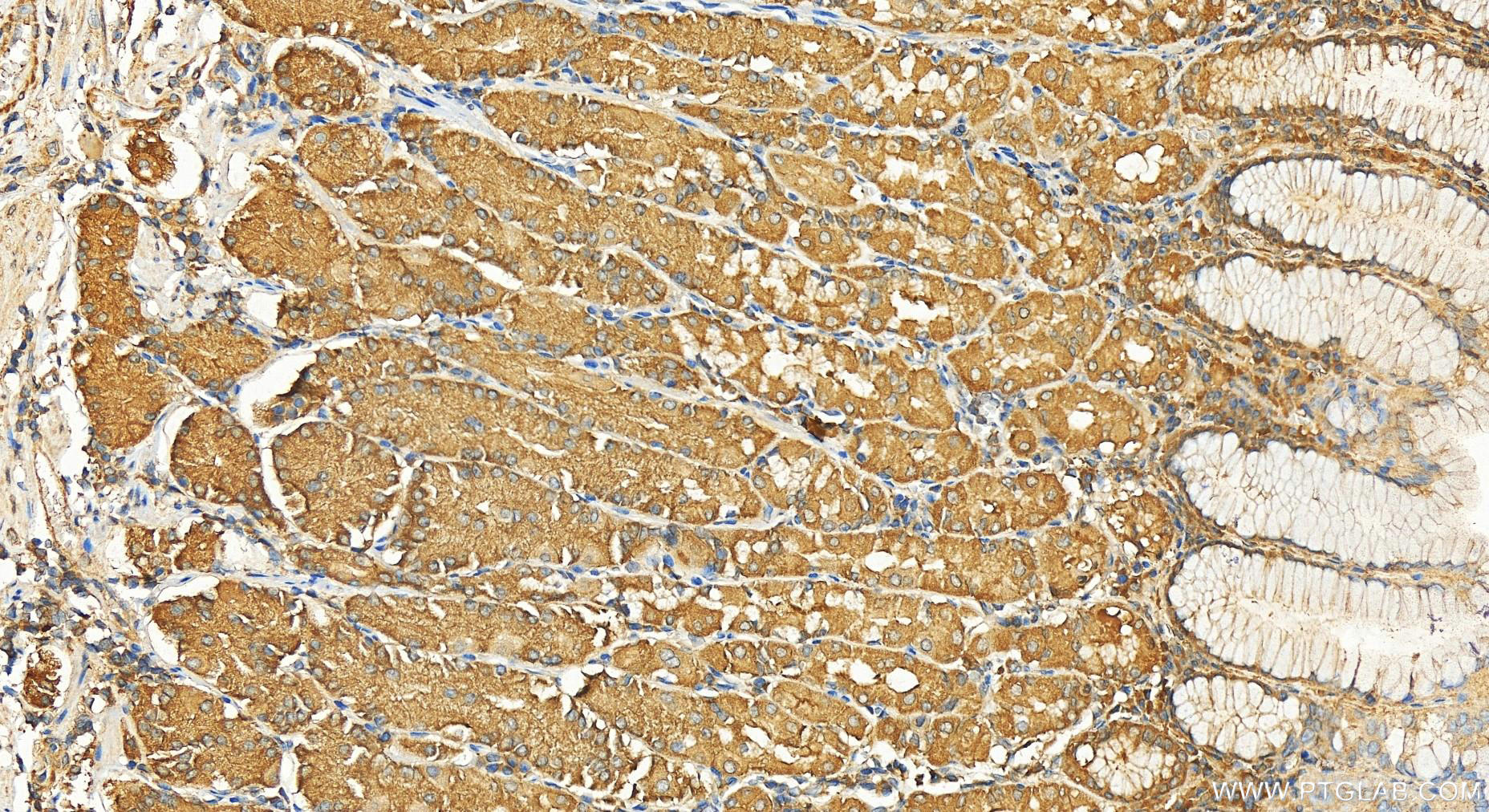 Immunohistochemistry (IHC) staining of human stomach tissue using SKIV2L Polyclonal antibody (11462-1-AP)