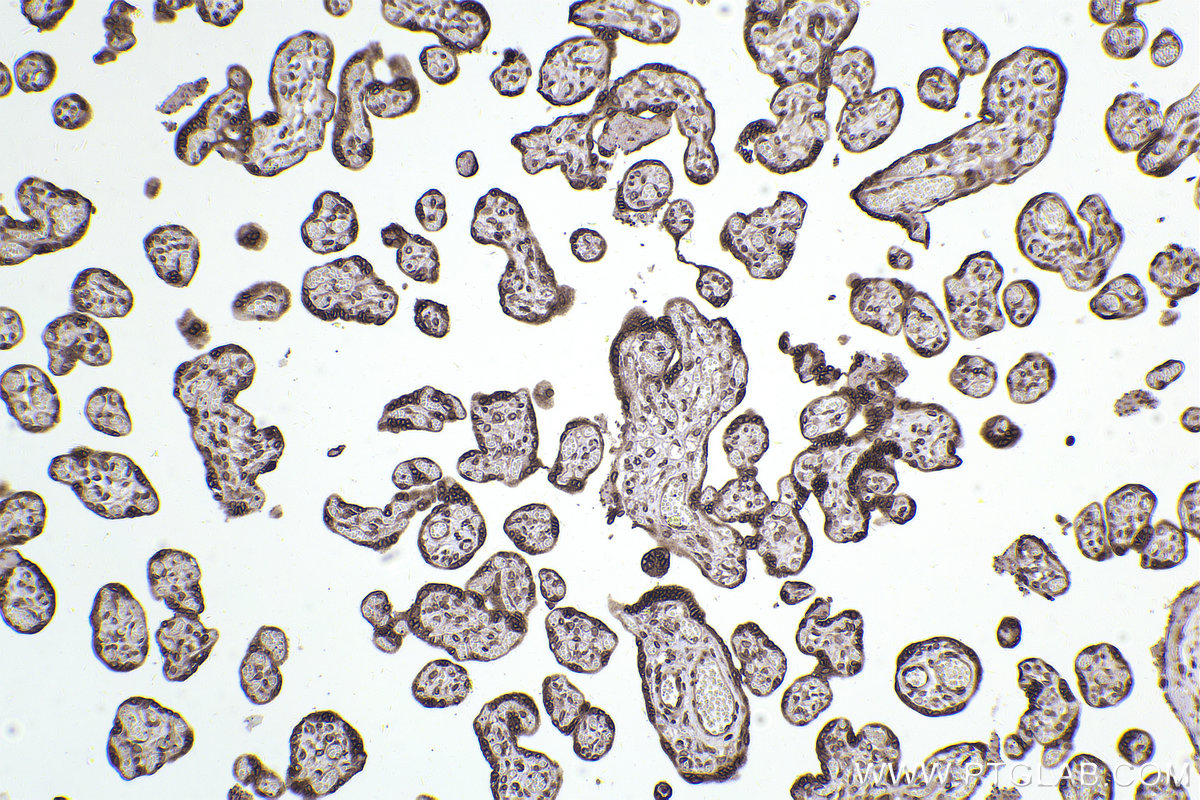 Immunohistochemistry (IHC) staining of human placenta tissue using SKIV2L Monoclonal antibody (68547-1-Ig)