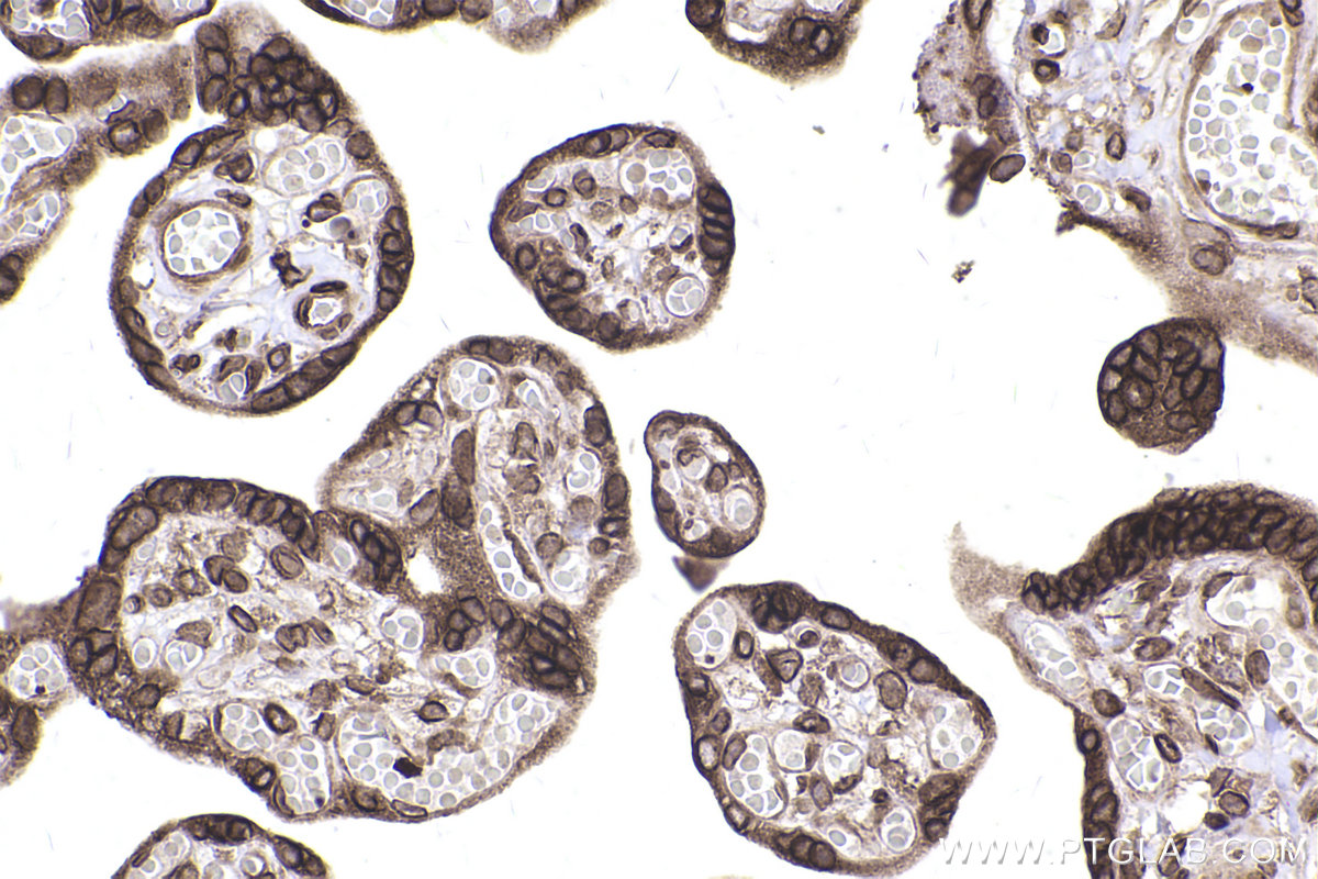 Immunohistochemistry (IHC) staining of human placenta tissue using SKIV2L Monoclonal antibody (68547-1-Ig)