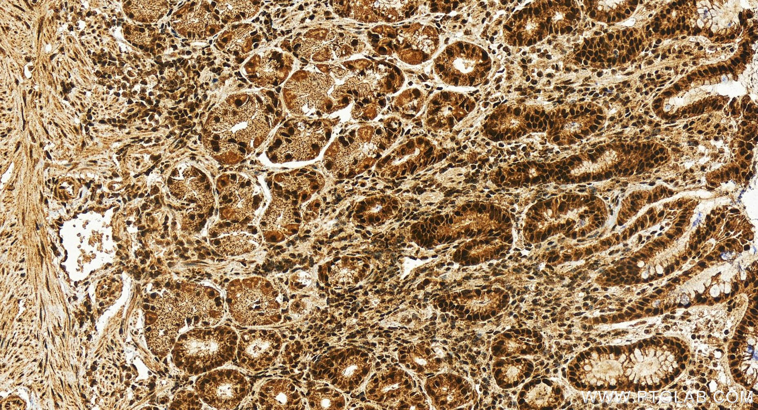 Immunohistochemistry (IHC) staining of human stomach tissue using SKIV2L2 Polyclonal antibody (12719-2-AP)