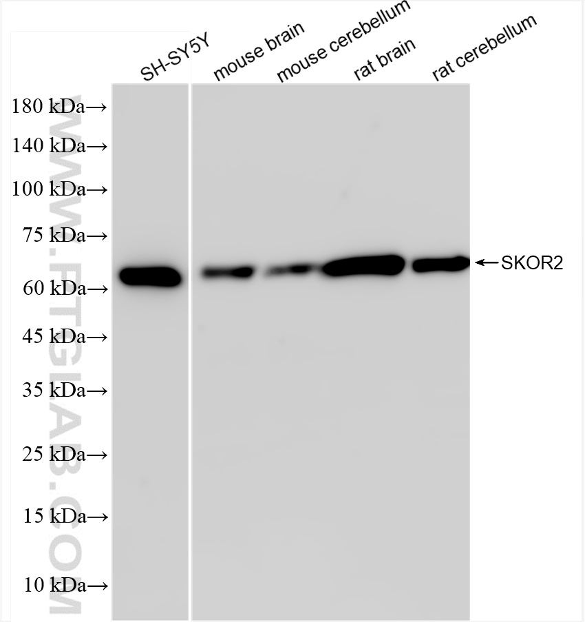 Western Blot (WB) analysis of various lysates using SKOR2 Recombinant antibody (84303-1-RR)