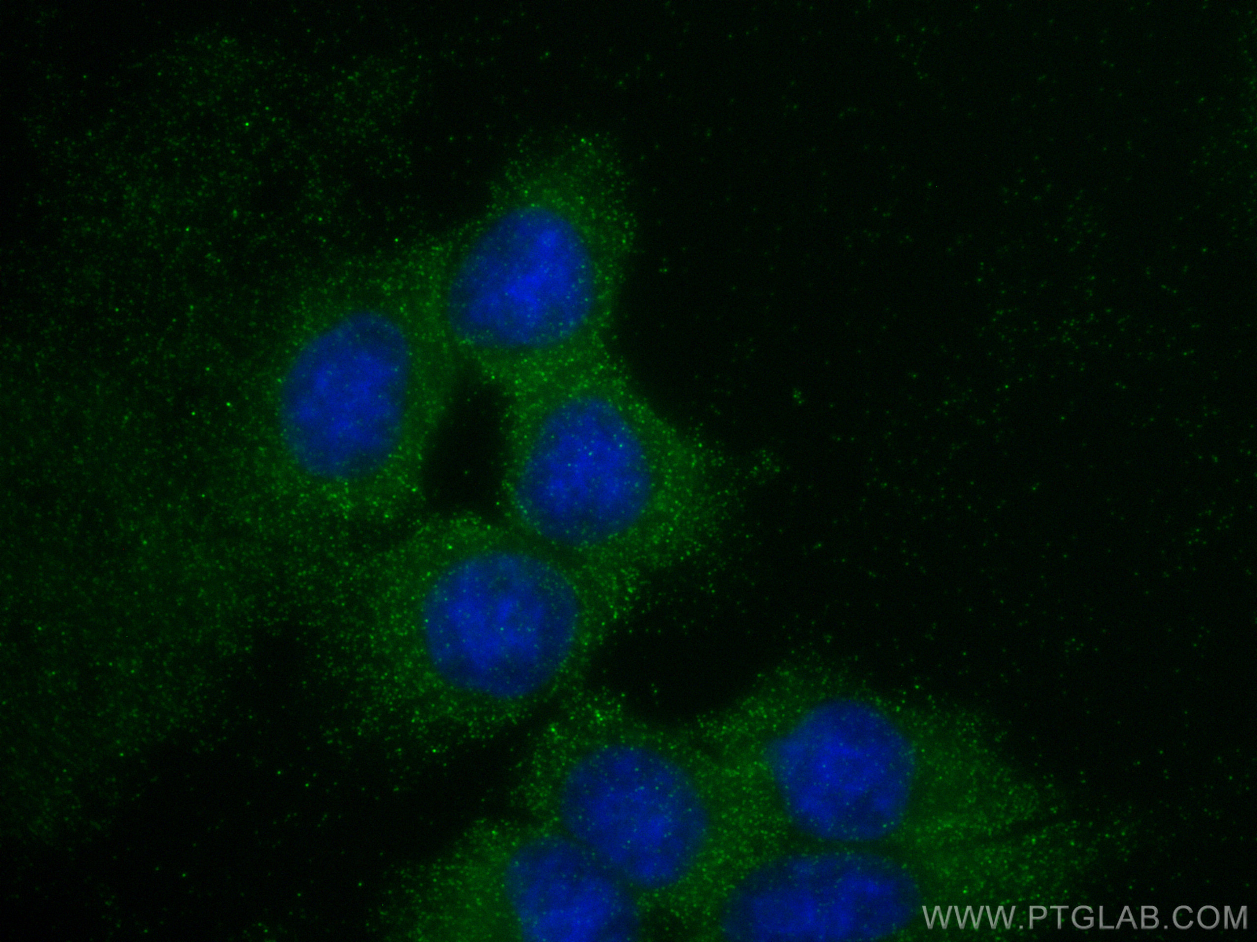 Immunofluorescence (IF) / fluorescent staining of HepG2 cells using SKP1 Polyclonal antibody (10990-2-AP)