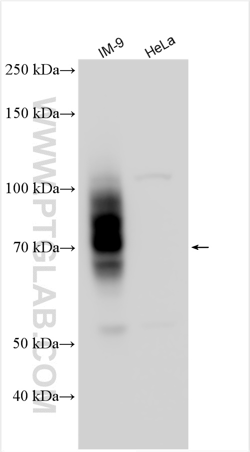 Western Blot (WB) analysis of various lysates using SLAMF7/CD319 Polyclonal antibody (30573-1-AP)