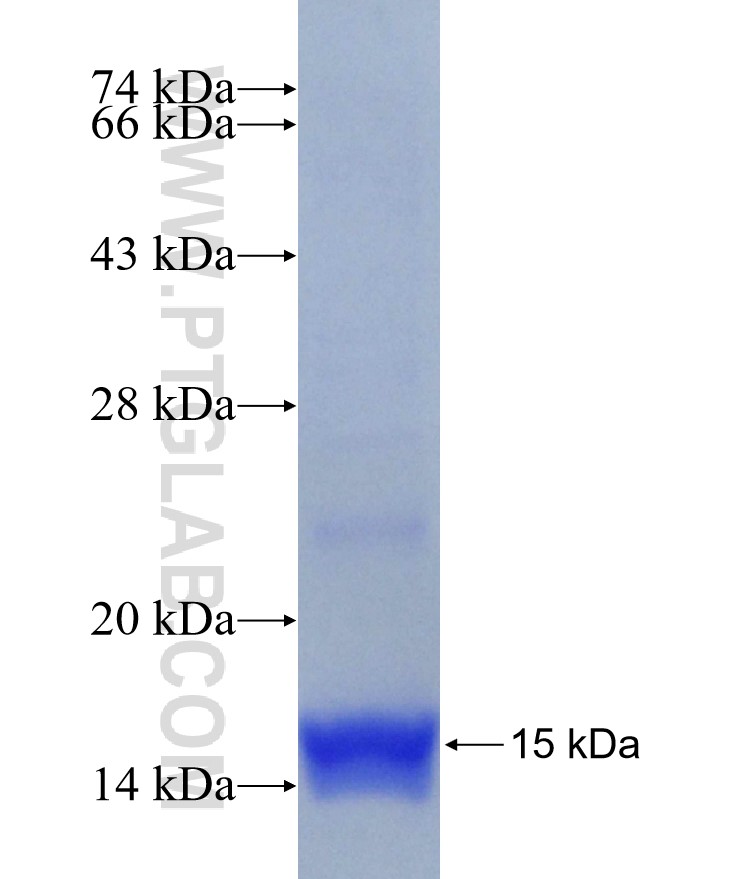 SLC10A2 fusion protein Ag29961 SDS-PAGE