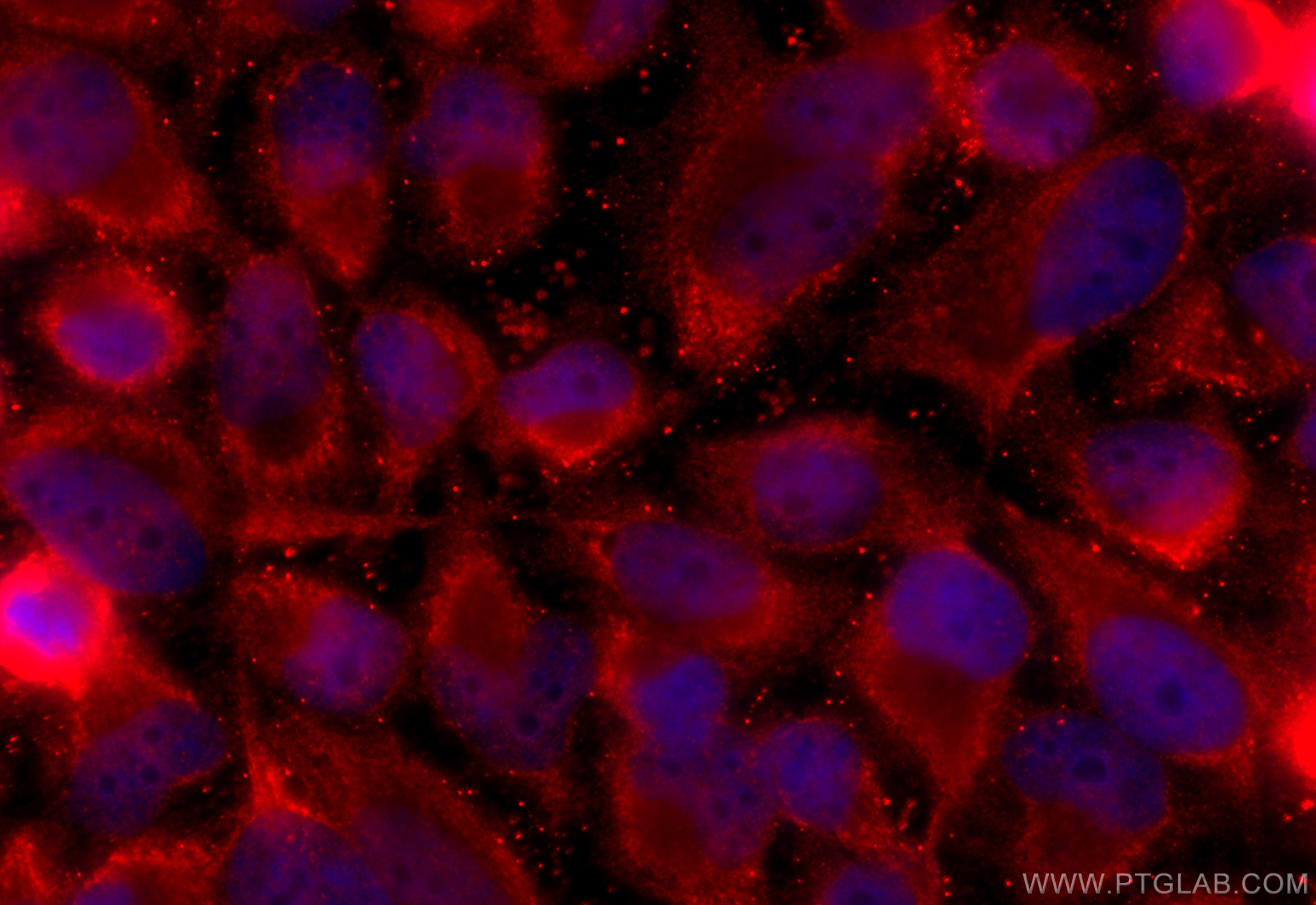 Immunofluorescence (IF) / fluorescent staining of HeLa cells using SLC10A3 Polyclonal antibody (19909-1-AP)