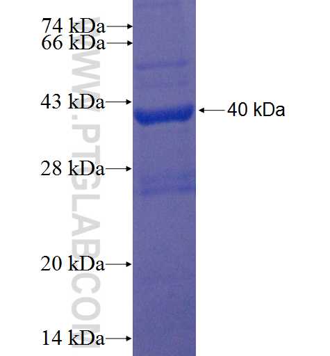 SLC10A5 fusion protein Ag22339 SDS-PAGE