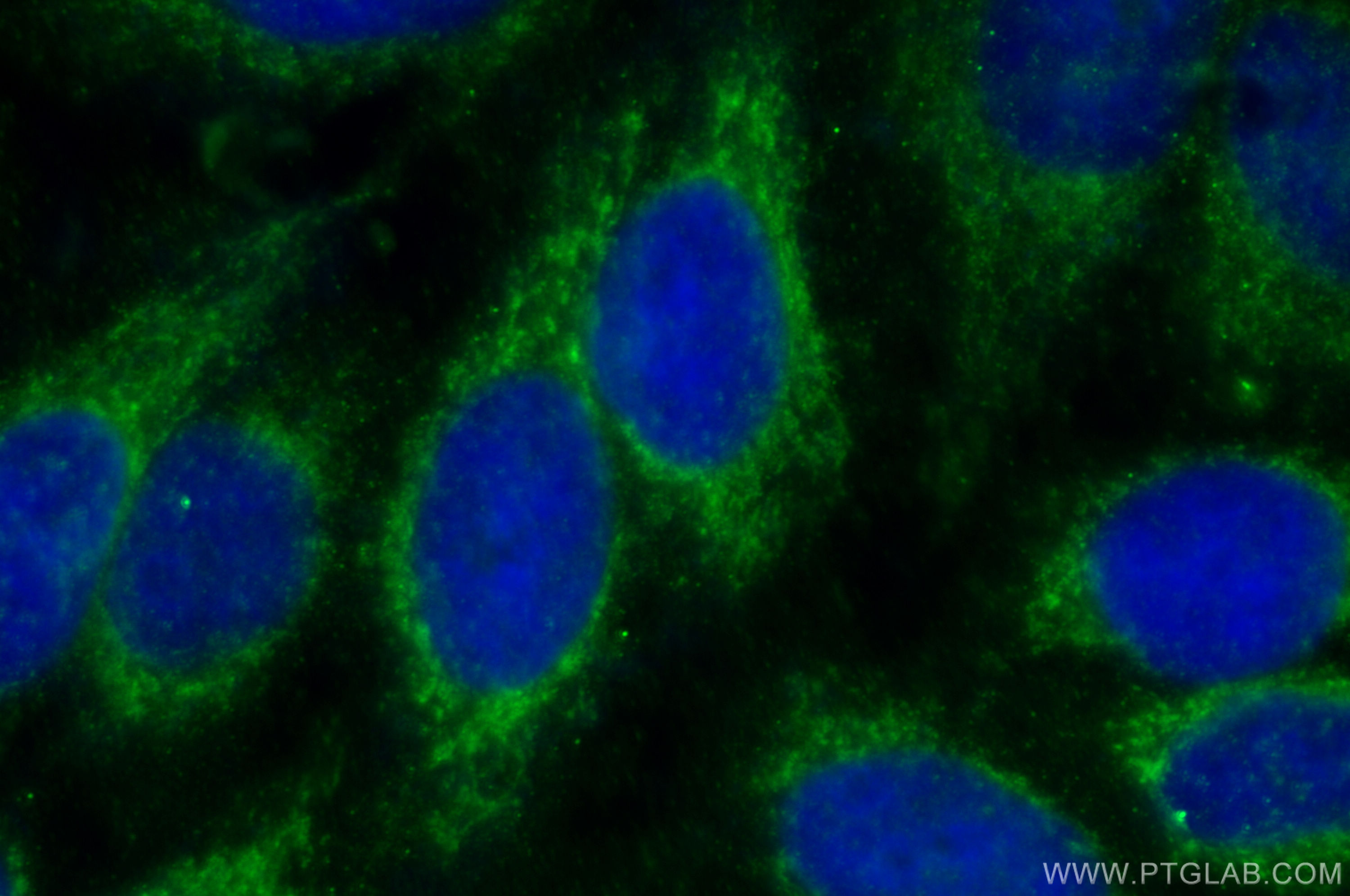 Immunofluorescence (IF) / fluorescent staining of HepG2 cells using DMT1 Polyclonal antibody (20507-1-AP)