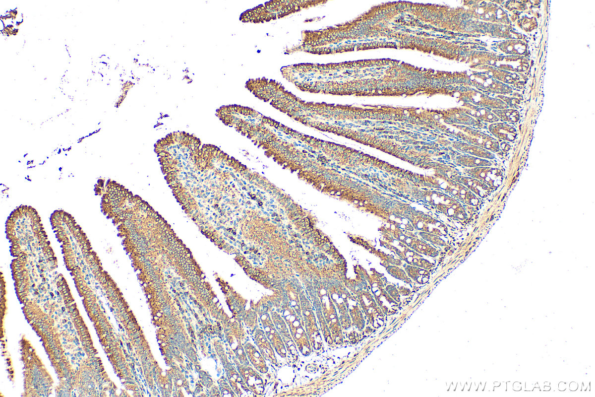 Immunohistochemistry (IHC) staining of mouse small intestine tissue using DMT1 Polyclonal antibody (20507-1-AP)