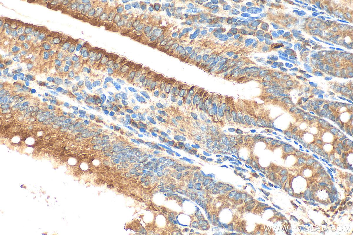 Immunohistochemistry (IHC) staining of mouse small intestine tissue using DMT1 Polyclonal antibody (20507-1-AP)