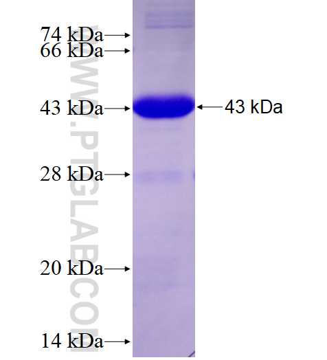 SLC12A2 fusion protein Ag27901 SDS-PAGE