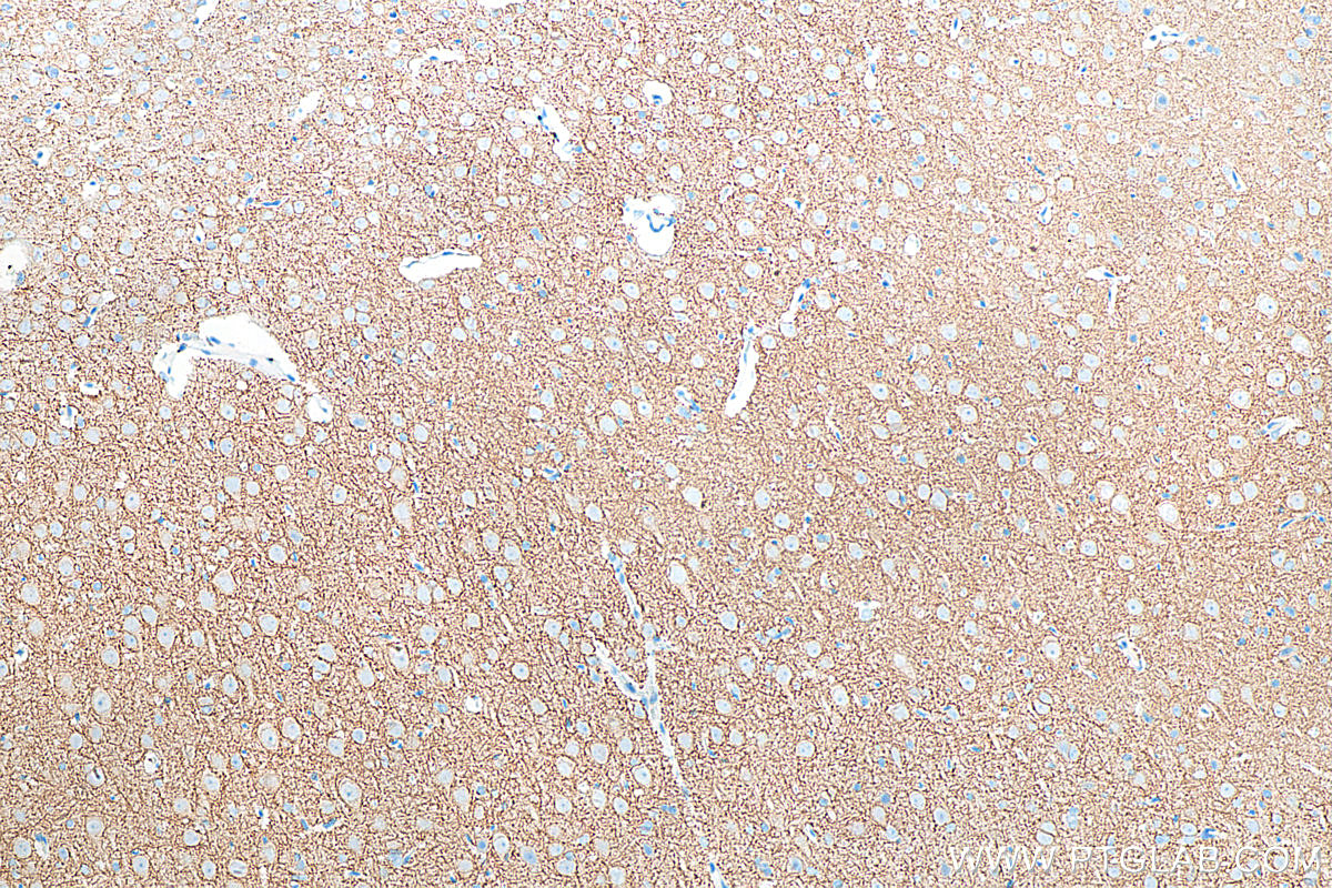 Immunohistochemistry (IHC) staining of rat brain tissue using KCC2/SLC12A5-Specific Polyclonal antibody (19565-1-AP)