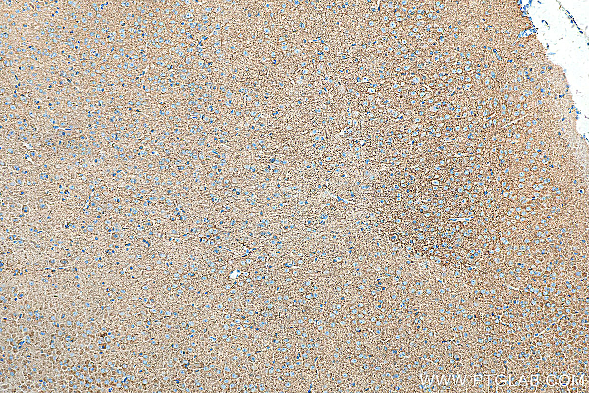 Immunohistochemistry (IHC) staining of mouse brain tissue using KCC2/SLC12A5-Specific Polyclonal antibody (19565-1-AP)