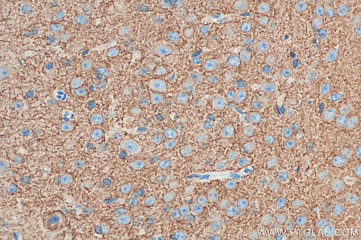 Immunohistochemistry (IHC) staining of mouse brain tissue using KCC2/SLC12A5-Specific Polyclonal antibody (19565-1-AP)