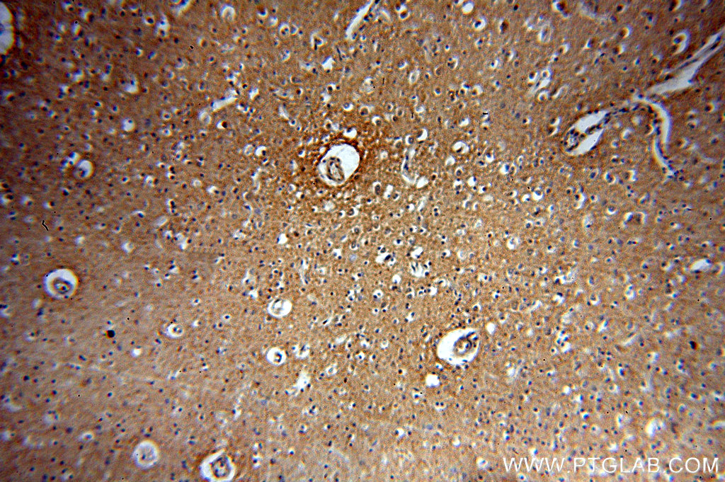 Immunohistochemistry (IHC) staining of human brain tissue using KCC2/SLC12A5-Specific Polyclonal antibody (19565-1-AP)