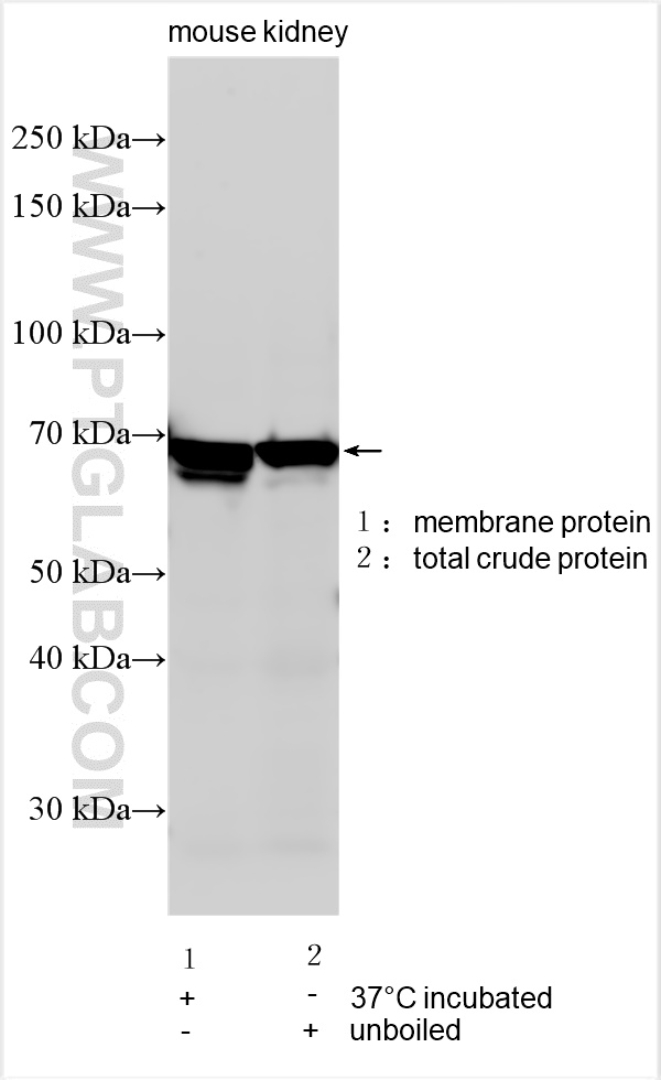 Western Blot (WB) analysis of various lysates using SLC12A8 Polyclonal antibody (12242-1-AP)