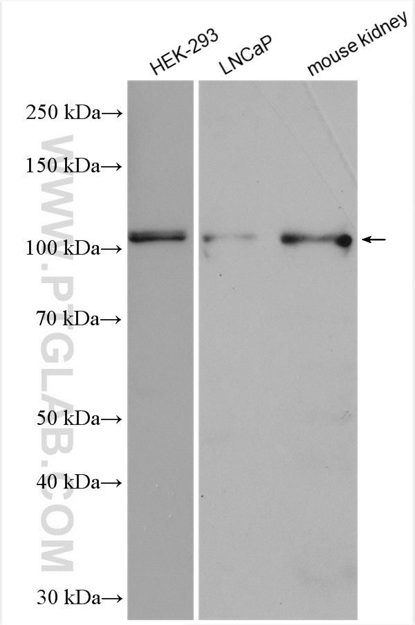 Western Blot (WB) analysis of various lysates using SLC12A9 Polyclonal antibody (26827-1-AP)