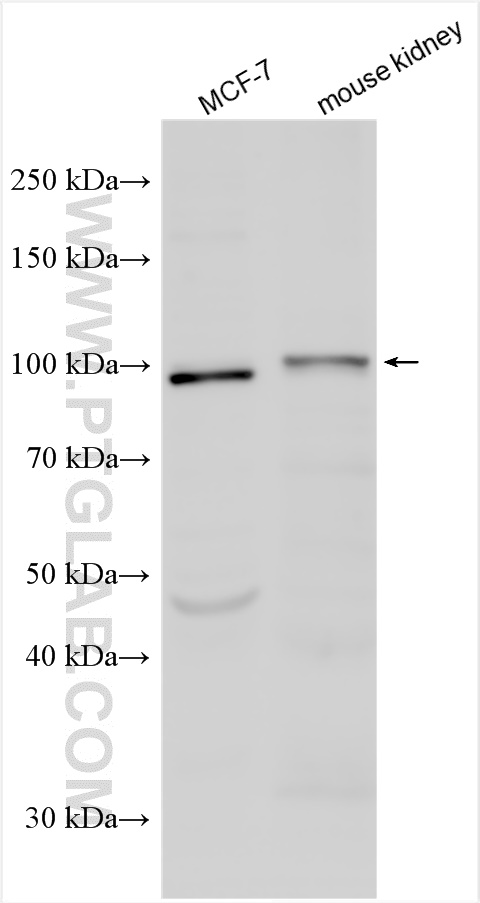 Western Blot (WB) analysis of various lysates using SLC12A9 Polyclonal antibody (26827-1-AP)