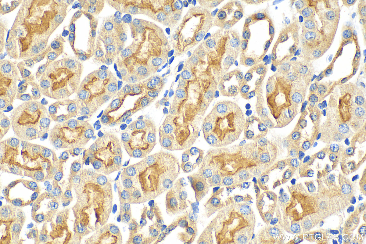 Immunohistochemistry (IHC) staining of mouse kidney tissue using SLC13A2 Polyclonal antibody (21722-1-AP)