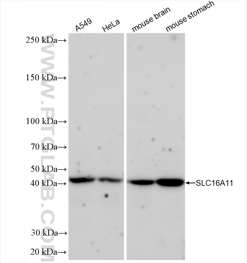 Western Blot (WB) analysis of various lysates using SLC16A11 Recombinant antibody (83239-5-RR)