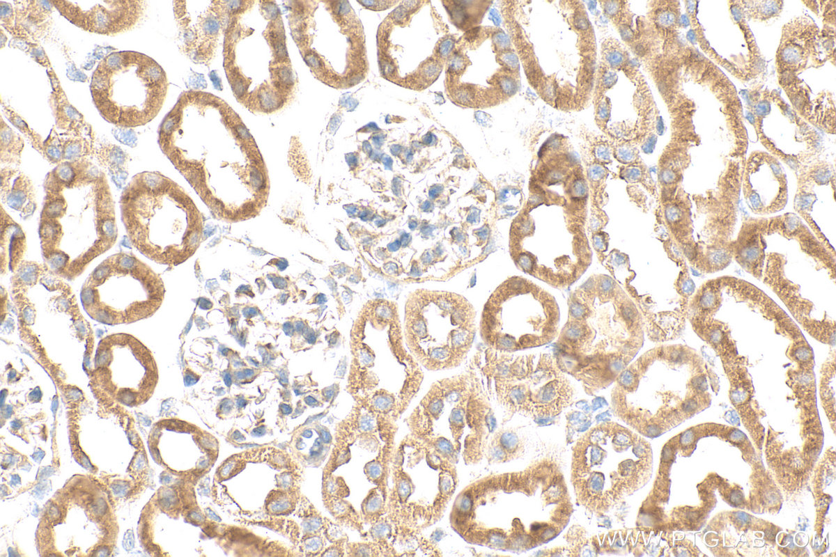 Immunohistochemistry (IHC) staining of mouse kidney tissue using SLC16A12 Polyclonal antibody (20553-1-AP)