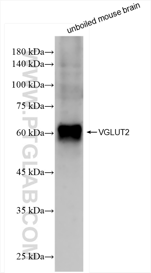 Western Blot (WB) analysis of mouse brain tissue using VGLUT2 Recombinant antibody (84083-2-RR)