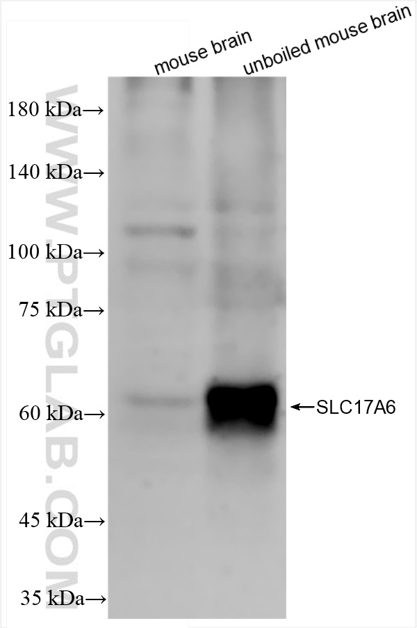 Western Blot (WB) analysis of various lysates using VGLUT2 Recombinant antibody (84083-2-RR)