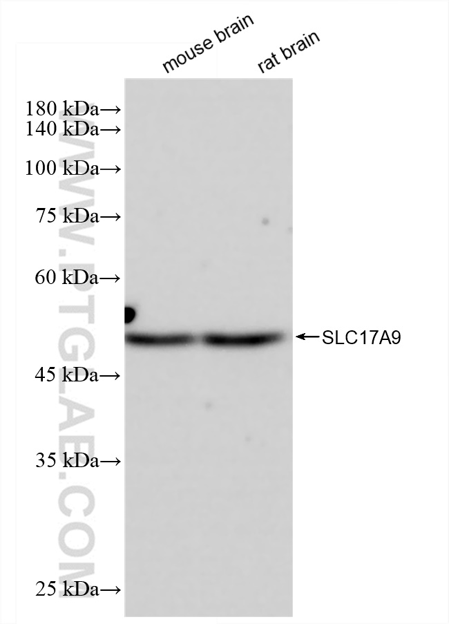 Western Blot (WB) analysis of various lysates using SLC17A9 Recombinant antibody (83505-1-RR)