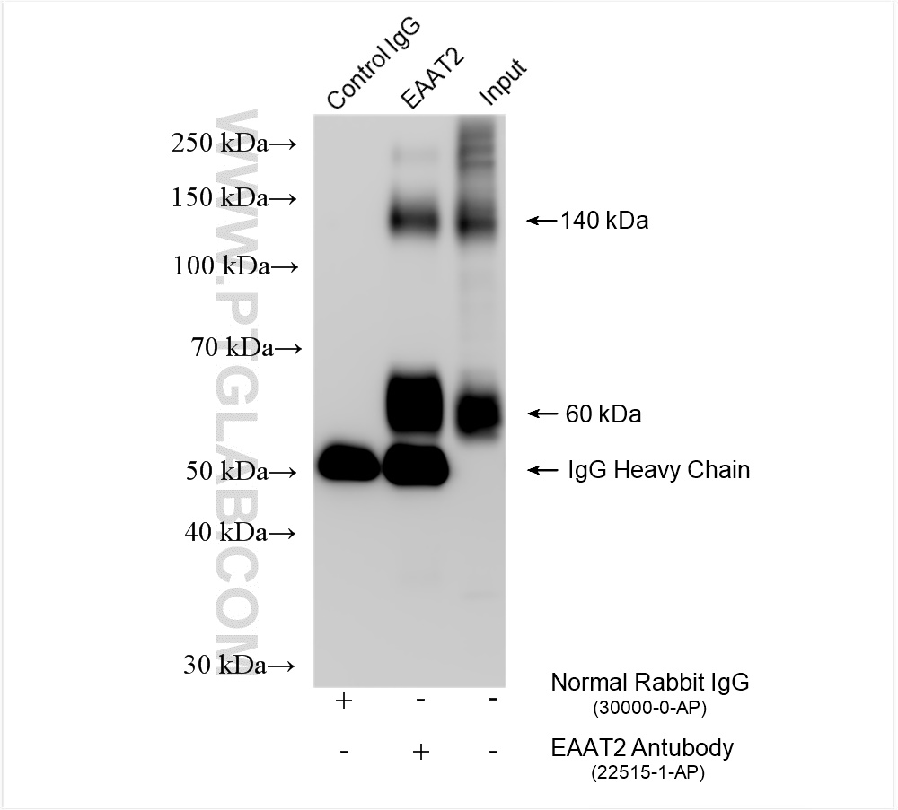 Immunoprecipitation (IP) experiment of mouse brain tissue using EAAT2 Polyclonal antibody (22515-1-AP)