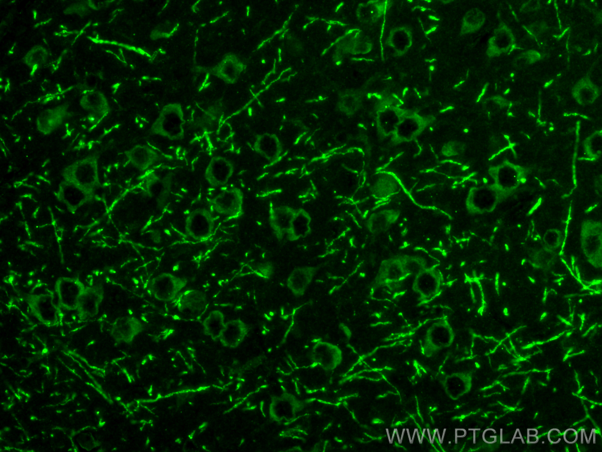 Immunofluorescence (IF) / fluorescent staining of mouse brain tissue using SLC20A2 Polyclonal antibody (12820-1-AP)