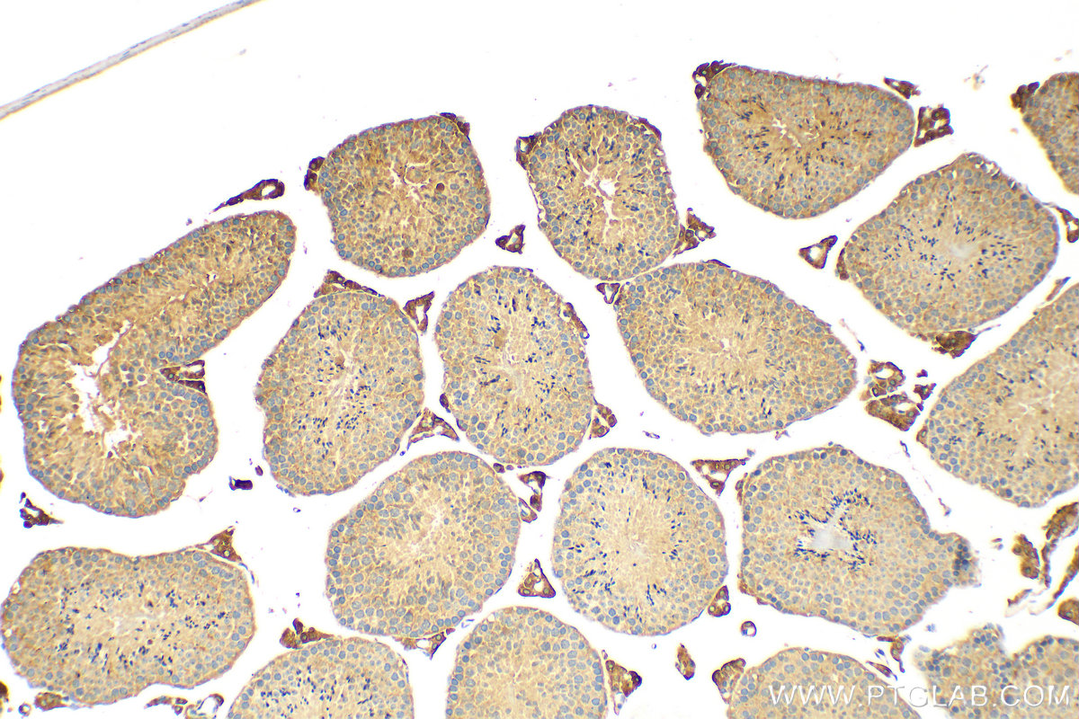 Immunohistochemistry (IHC) staining of mouse testis tissue using SLC20A2 Polyclonal antibody (12820-1-AP)