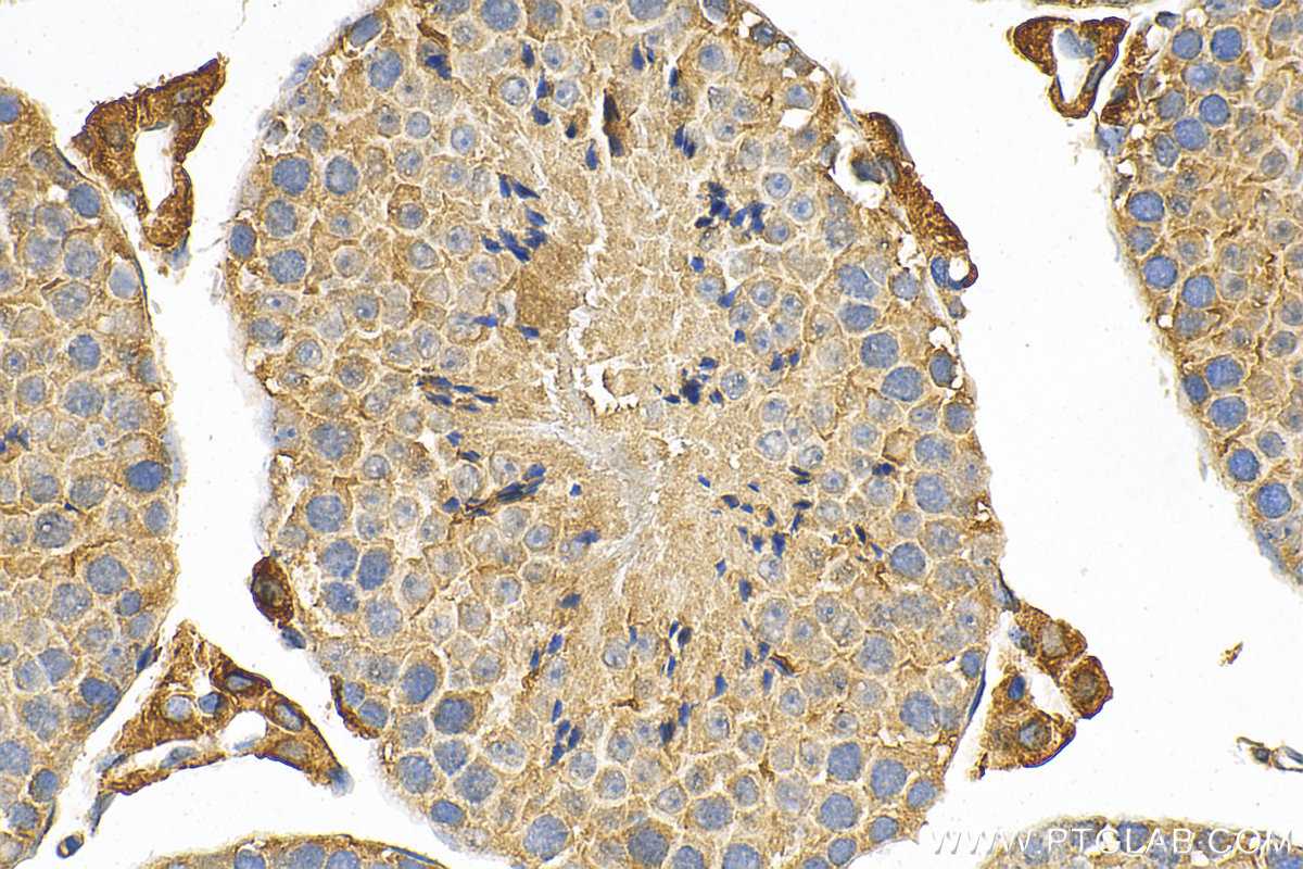 Immunohistochemistry (IHC) staining of mouse testis tissue using SLC20A2 Polyclonal antibody (12820-1-AP)