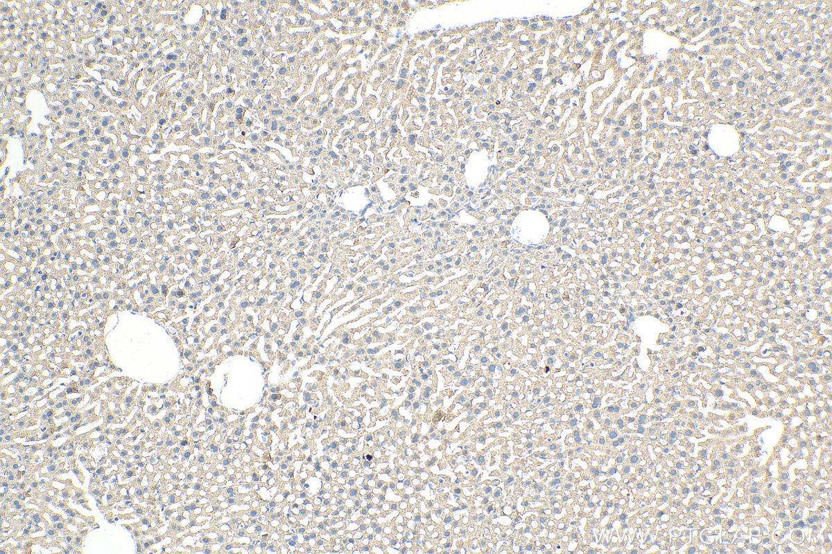 Immunohistochemistry (IHC) staining of mouse liver tissue using SLC22A10 Polyclonal antibody (31069-1-AP)