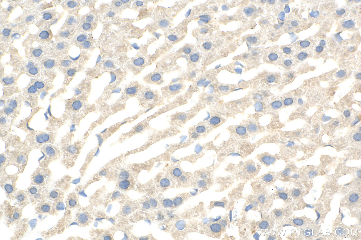 Immunohistochemistry (IHC) staining of mouse liver tissue using SLC22A10 Polyclonal antibody (31069-1-AP)