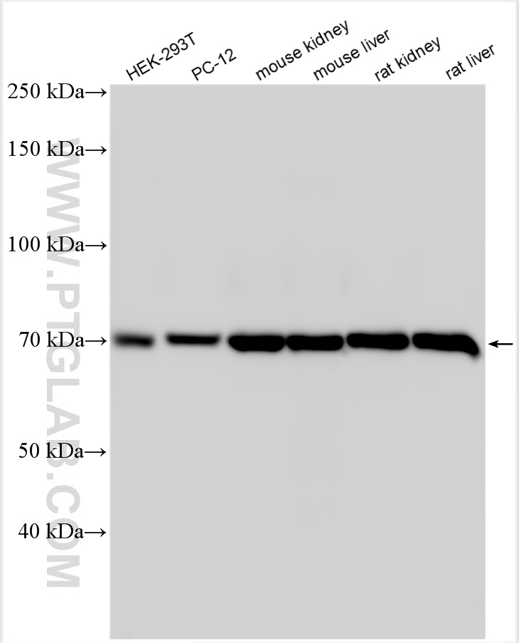 Western Blot (WB) analysis of various lysates using SLC22A10 Polyclonal antibody (31069-1-AP)