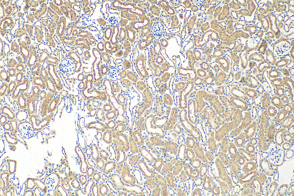 Immunohistochemistry (IHC) staining of mouse kidney tissue using URAT1 Polyclonal antibody (14937-1-AP)