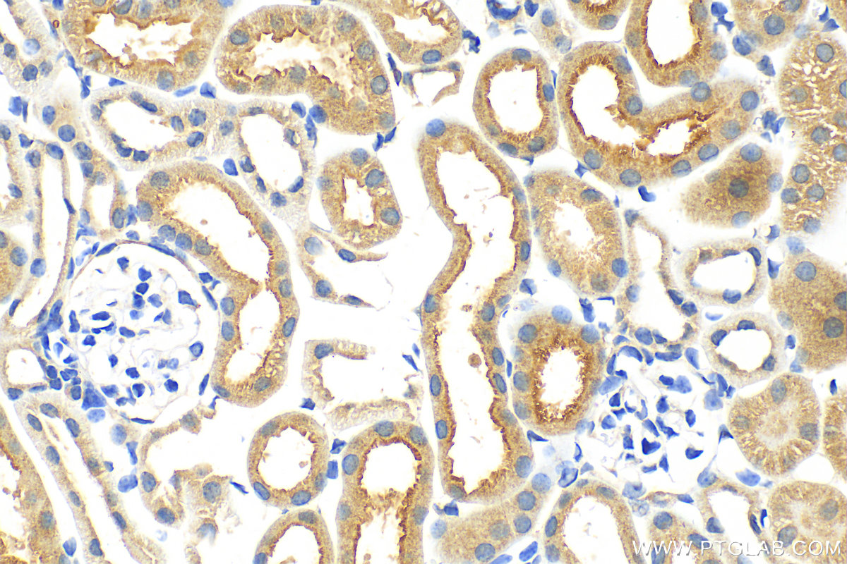 Immunohistochemistry (IHC) staining of mouse kidney tissue using URAT1 Polyclonal antibody (14937-1-AP)