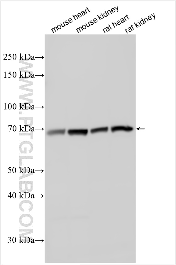 Western Blot (WB) analysis of various lysates using URAT1 Polyclonal antibody (14937-1-AP)