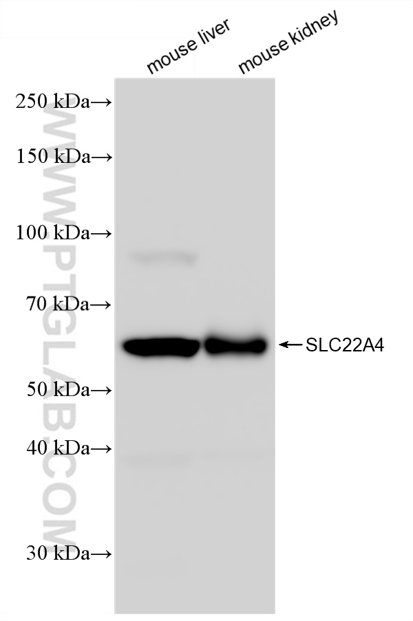 Western Blot (WB) analysis of various lysates using SLC22A4 Recombinant antibody (83192-1-RR)