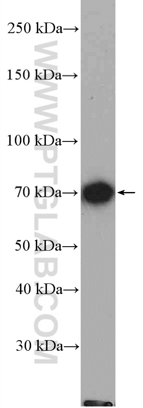 Western Blot (WB) analysis of mouse kidney tissue using SLC22A7 Polyclonal antibody (26796-1-AP)