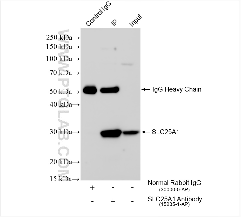 Immunoprecipitation (IP) experiment of HeLa cells using SLC25A1 Polyclonal antibody (15235-1-AP)