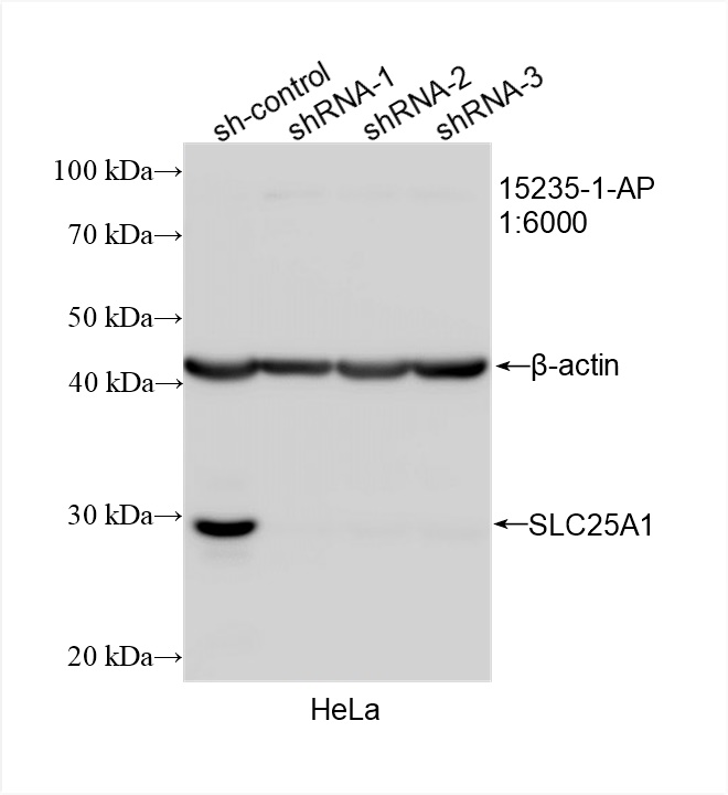 Western Blot (WB) analysis of HeLa cells using SLC25A1 Polyclonal antibody (15235-1-AP)