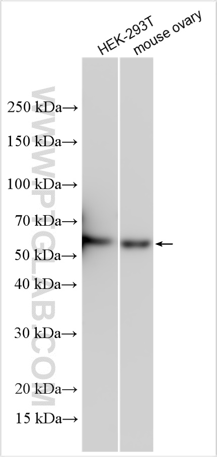 Western Blot (WB) analysis of various lysates using SLC25A13 Polyclonal antibody (10789-1-AP)