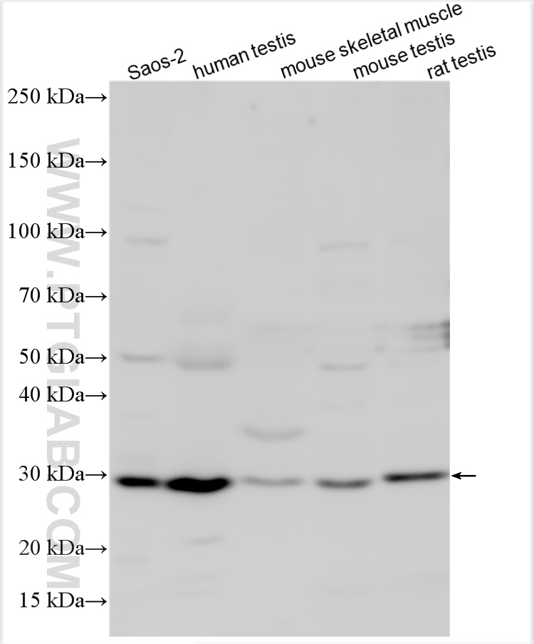 Western Blot (WB) analysis of various lysates using SLC25A20 Polyclonal antibody (19363-1-AP)