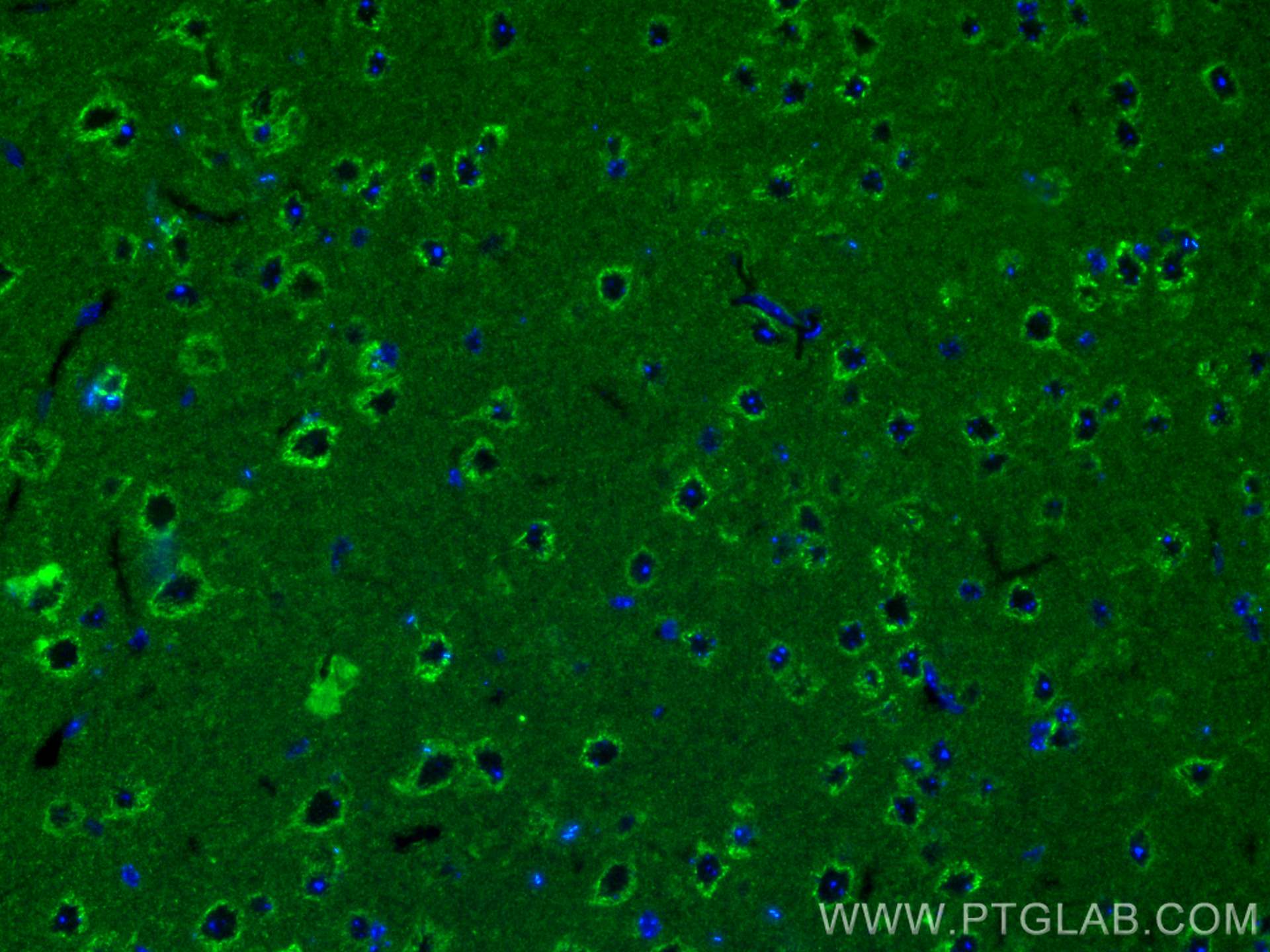 Immunofluorescence (IF) / fluorescent staining of mouse brain tissue using SLC25A22 Polyclonal antibody (25402-1-AP)