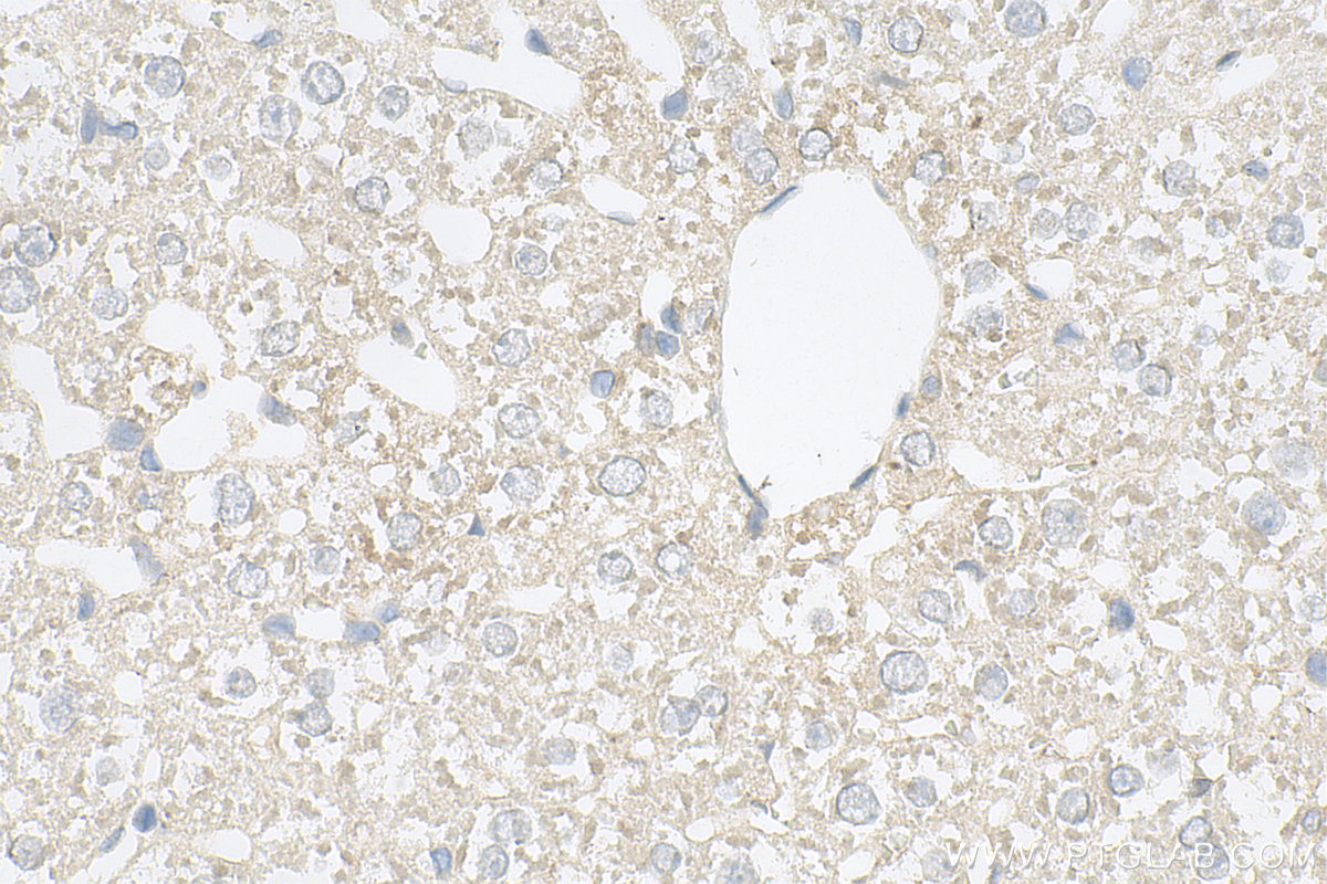 Immunohistochemistry (IHC) staining of rat liver tissue using SLC25A3 Polyclonal antibody (10420-1-AP)