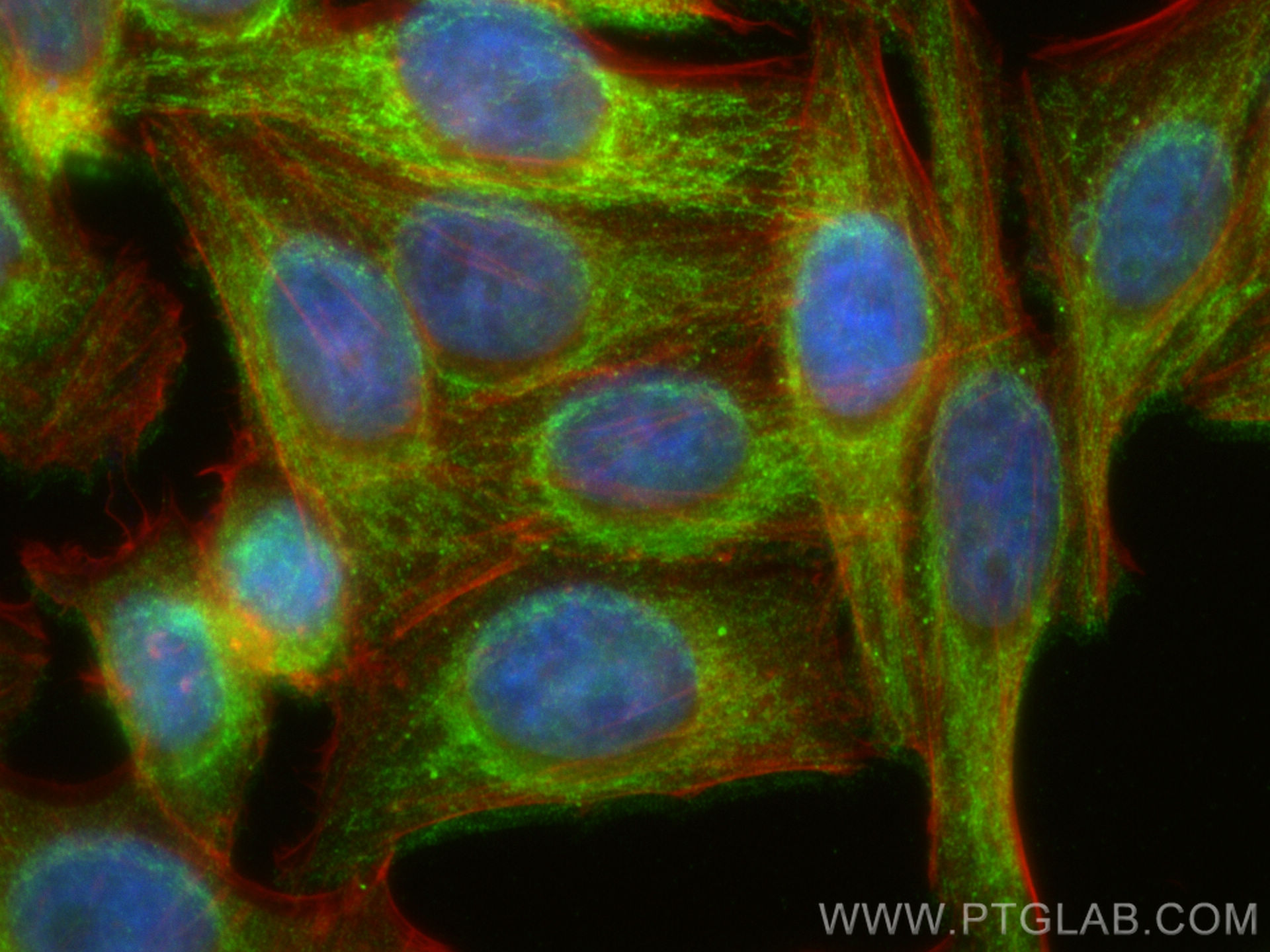 Immunofluorescence (IF) / fluorescent staining of HepG2 cells using SLC25A36 Polyclonal antibody (26379-1-AP)